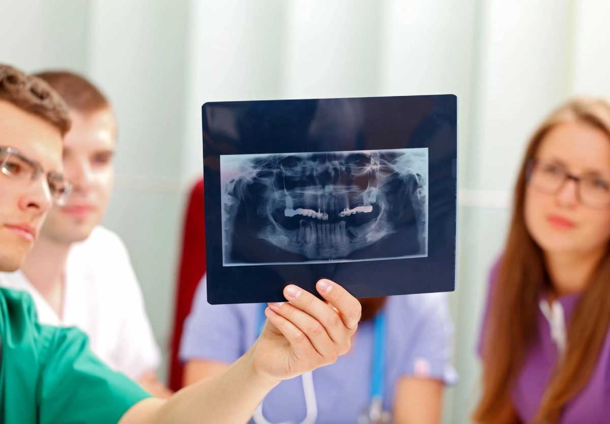 A person holding up an x-ray picture