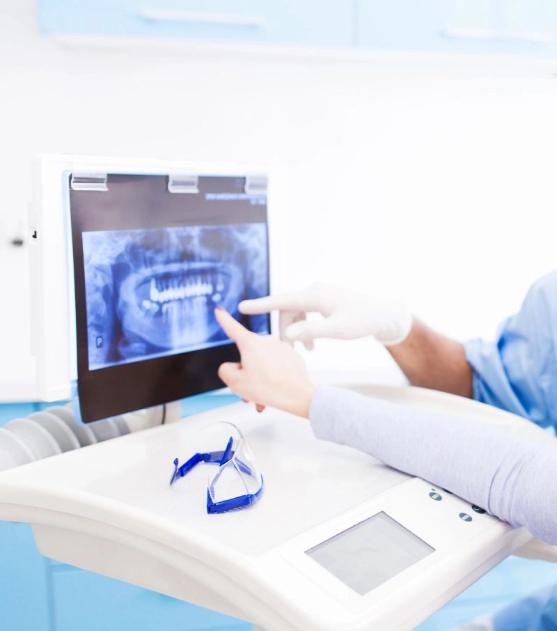 A dentist is pointing to an x-ray on the computer screen.