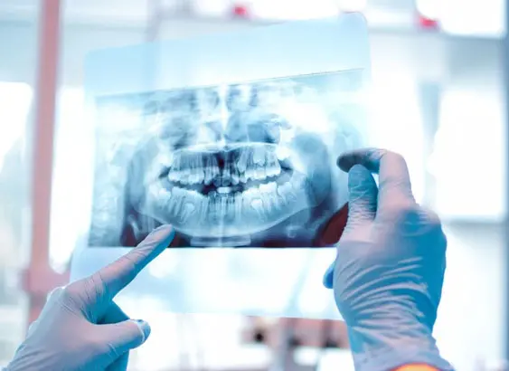 A person holding up an x-ray of teeth.